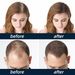 moon men's East spray hairline thick growth dense anti drop hair fixative_viptrois.com