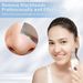 Ultrasonic Facial Skin Scrubber Spatula Blackhead Remover Device LCD Display_viptrois.com