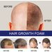 East Moon foam Men's Dense Moisturizing Care Deep Repairing Hair Root Follicles_viptrois.com
