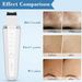 Face Skin Scrubber, Electric Ultrasonic EMS Ion Blue/Red Light Face Cleanser_viptrois.com