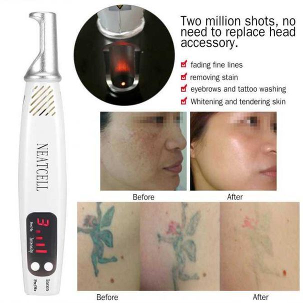 Handheald Red Light Picosecond Laser Pen Scar Tattoo Removal Melanin Dilute Device + Repair Set - intl_viptrois.com