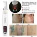 Handheald Red Light Picosecond Laser Pen Scar Tattoo Removal Melanin Dilute Device + Repair Set - intl_viptrois.com