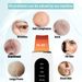 Skin Scrubber Peeg Blackhead Remover Deep Face Cleaning Ultrasonic Ion Ance Pore Cleaner Facial Shovel Cleanser 2025_viptrois.com