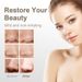 Facial Pore Removing Cleaner Beauty Device For Cleansing Blackheads, Household Electric Acne Suction 2025_viptrois.com