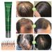 South Moon Anti-Lose Thick Hair Essence Hair Care Nutrient Solution Massage Repair Root Thick Hair Essence_viptrois.com