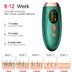 Laser Haaren tfernung austauschbare Lampe Flash Frauen Photo pilator Bikini Trimmer IPL Epilierer_viptrois.com