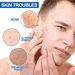 Men's Multi Effect Face Cream Moisturizing, Moisturizing, Cleaning Pores, Acne Care And Tender Skin_viptrois.com