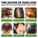 South Moon Ginger Thick Hair Roller Ball Scalp Care Nourishes Hair Roots, Strengthens Hair Thick Hair Essential Oil Roller Ball_viptrois.com