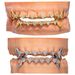Real Gold Plated 8 Teeth Micro Inlaid Heart Full Dia HIPHOP Braces Halloween Hip Hop Accessories_viptrois.com