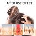 EAST MOON essence Anti dropping Firm, Strong, Thick and Nourishing Root Dense Hair Care_viptrois.com