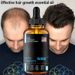 Hair Growth Essential oils Products Ginger Essence Fast Regrowth Serum Beard Growth Oil Hair Loss Care Beauty Scalp Treatment_viptrois.com