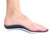 EVA flat foot correction insole for inward turned feet, outward turned flat feet, XO shaped legs correction for high arch pads for men and women_viptrois.com