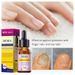 Nail Cuticle Care Liquid Finger Toe Intensive Repair And Growth Essence_viptrois.com