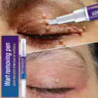 Blackhead & Blemish Removers_viptrois