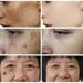 Beauty Care shop Whitening Freckle Glutathione Face Cream Remove Dark Spots Lighten Melasma Melanin Fade Acne Scars Anti-Aging_viptrois.com