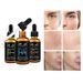 PEIME 30ml * 3PCS Face Essence Kit_viptrois.com