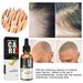 South Moon Hair Essential Oil Hair Care Nutritional Solution Hair Root and Scalp Quick Essential Oil Anti-Fall Hair Nutritional Solution_viptrois.com