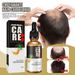 South Moon Hair Essential Oil Hair Care Nutritional Solution Hair Root and Scalp Quick Essential Oil Anti-Fall Hair Nutritional Solution_viptrois.com