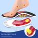 Breathable & Shock-Absorbing Orthotic Insoles For Men & Women – Arch Support, Lightweight & Durable, Universal Fit For All Shoes (Black Mesh)_viptrois.com