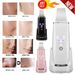 Ultrasonic Skin Scrubber Blackhead Cleaner Skin Spatula Deep Skin Facial Cleaner_viptrois.com