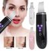 Ultrasonic Skin Scrubber Blackhead Cleaner Skin Spatula Deep Skin Facial Cleaner_viptrois.com