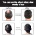 Product Effective Anti-Loss Serum Fast Growth Prevent Baldness Treatment Alopecia Women Men Hair Care_viptrois.com