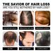 South Moon Hair Essential Oil Hair Care Nutritional Solution Hair Root and Scalp Quick Essential Oil Anti-Fall Hair Nutritional Solution_viptrois.com