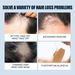 moon men's East spray hairline thick growth dense anti drop hair fixative_viptrois.com