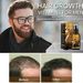 Anti 20Ml Biotin Loss Spray Scalp Treatment Products Fast Growing Hair Care Essential Oils For Men_viptrois.com