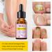 Nail Cuticle Care Liquid Finger Toe Intensive Repair And Growth Essence_viptrois.com