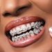 Real Gold Plated 8 Teeth Micro Inlaid Heart Full Dia HIPHOP Braces Halloween Hip Hop Accessories_viptrois.com