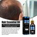 Product Effective Anti-Loss Serum Fast Growth Prevent Baldness Treatment Alopecia Women Men Hair Care_viptrois.com