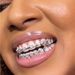Real Gold Plated 8 Teeth Micro Inlaid Heart Full Dia HIPHOP Braces Halloween Hip Hop Accessories_viptrois.com