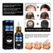 Product Effective Anti-Loss Serum Fast Growth Prevent Baldness Treatment Alopecia Women Men Hair Care_viptrois.com
