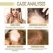 EELHOE Rosemary Dense Essential Repairs Damaged to Prevent Loss, Smooth, and Nourishing Hair Care Oil_viptrois.com