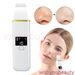 Ultrasonic Facial Skin Scrubber Spatula Blackhead Remover Device LCD Display_viptrois.com