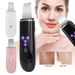 Ultrasonic Skin Scrubber Blackhead Cleaner Skin Spatula Deep Skin Facial Cleaner_viptrois.com