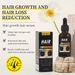 Hair Growth Essence Hair Growth Nourishing&Nourishing Original Solution For Foreign Trade_viptrois.com