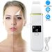 Skin Scrubber Blackhead Peeling Remover Facial Pore Deep Face Cleaner Spatula_viptrois.com
