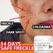 Beauty Care shop Whitening Freckle Glutathione Face Cream Remove Dark Spots Lighten Melasma Melanin Fade Acne Scars Anti-Aging_viptrois.com