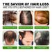 South Moon Anti-Lose Thick Hair Essence Hair Care Nutrient Solution Massage Repair Root Thick Hair Essence_viptrois.com