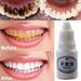 BeautyLife Oral Health Fresh Breath Deep Cleaning Teeth Stain Removal Antibacterial Liquid_viptrois.com